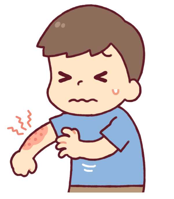 小児皮膚科
